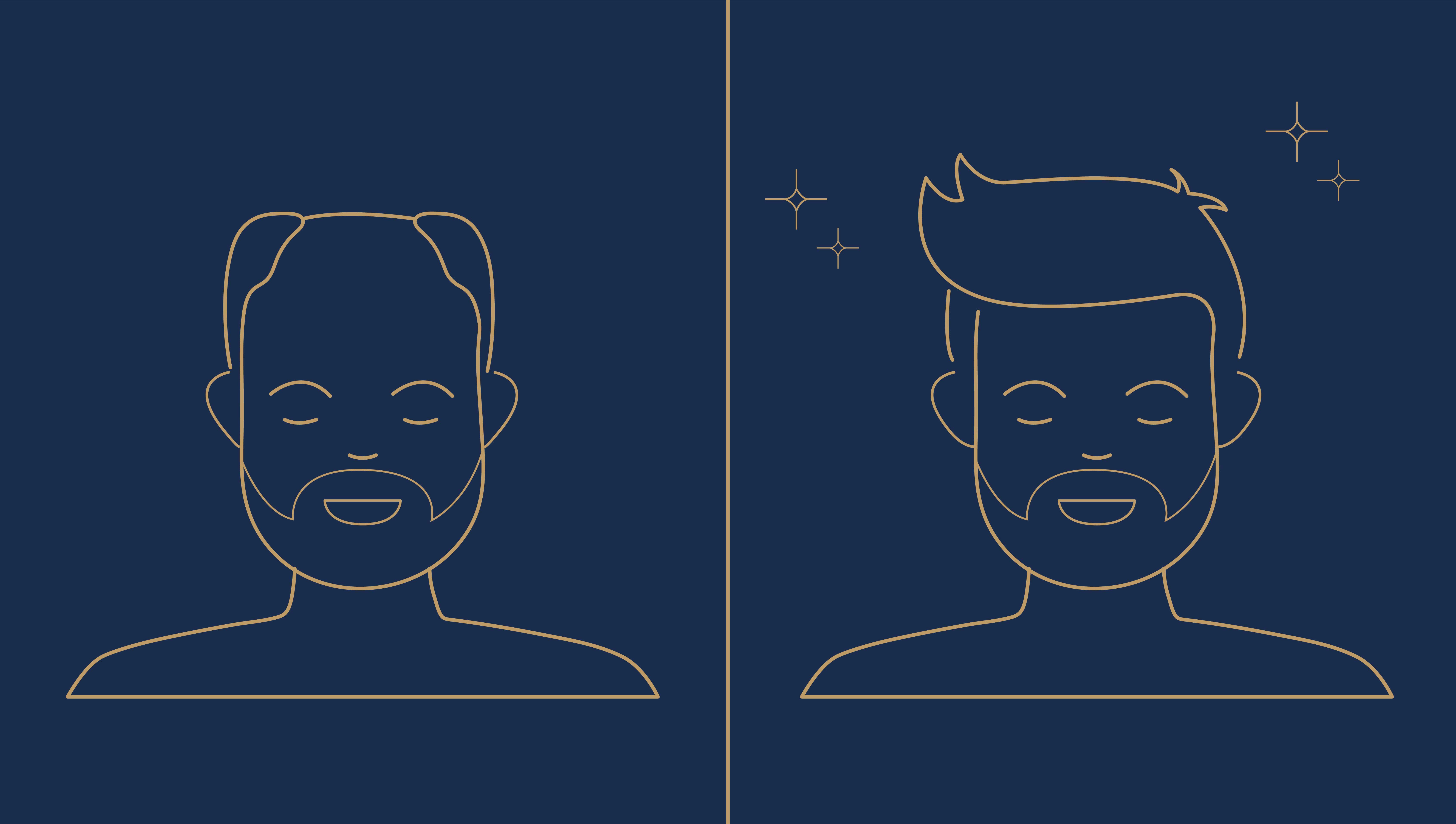 Hair Transplant