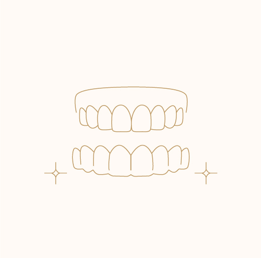 Clear Aligners