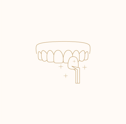 Dental Veneers