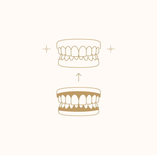 Gum Depigmentation