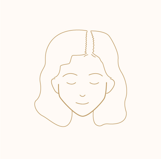 Hair Thinning