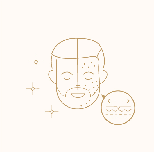 Open Pores Reduction