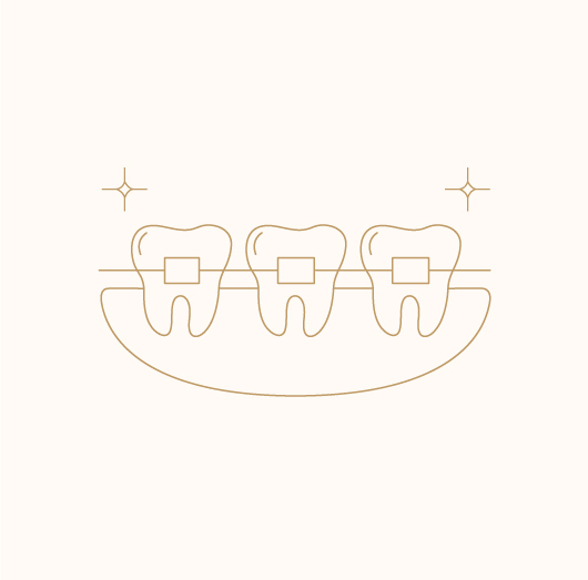 Orthodontic Treatment