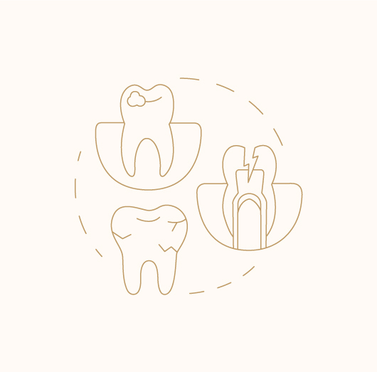 Tooth Decay And Cavity Treatment